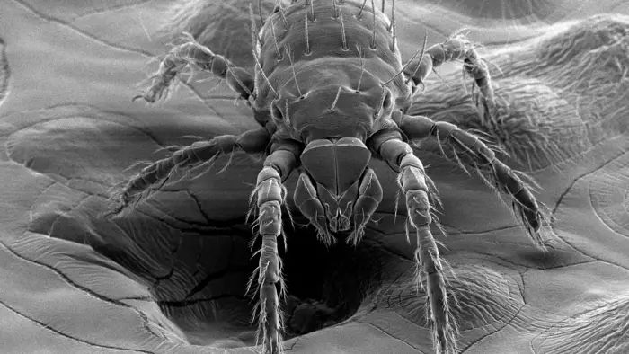 Bacterium Associated With Disease Found in North Carolina Chiggers ...