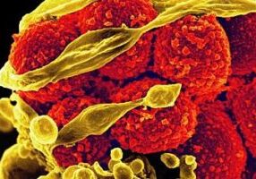 Scanning electron micrograph of methicillin-resistant Staphylococcus aureus bacteria (red, round items) killing and escaping from a human white blood cell. Courtesy of NIAID